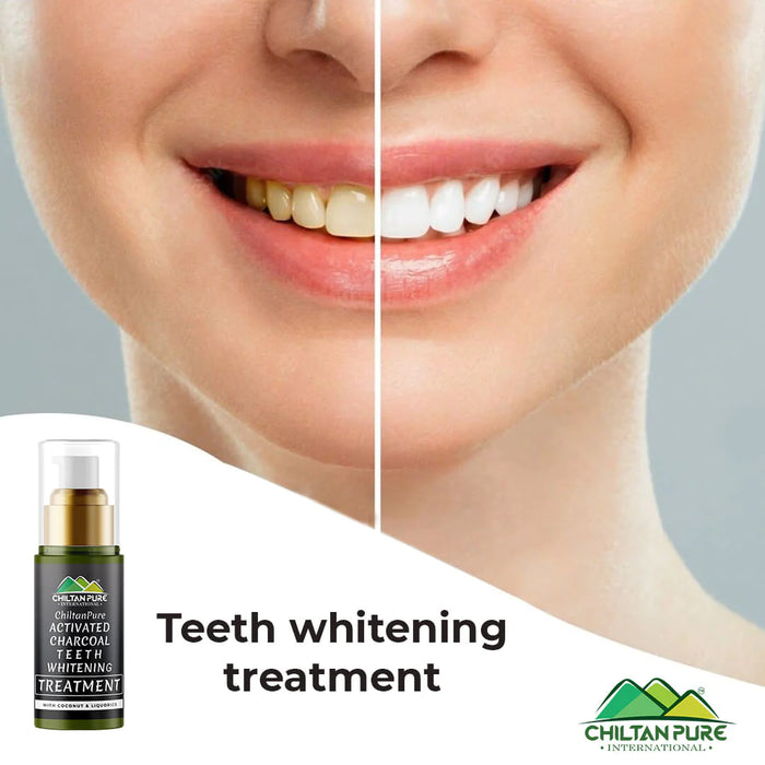 Activated Charcoal Teeth 🦷 Whitening Treatment